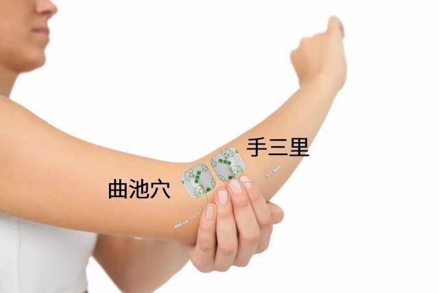 康好寿收招——中频帮助治疗偏偏瘫康复