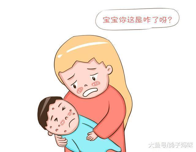 过度疲劳,小心带状疱疹,孕期也容易发作