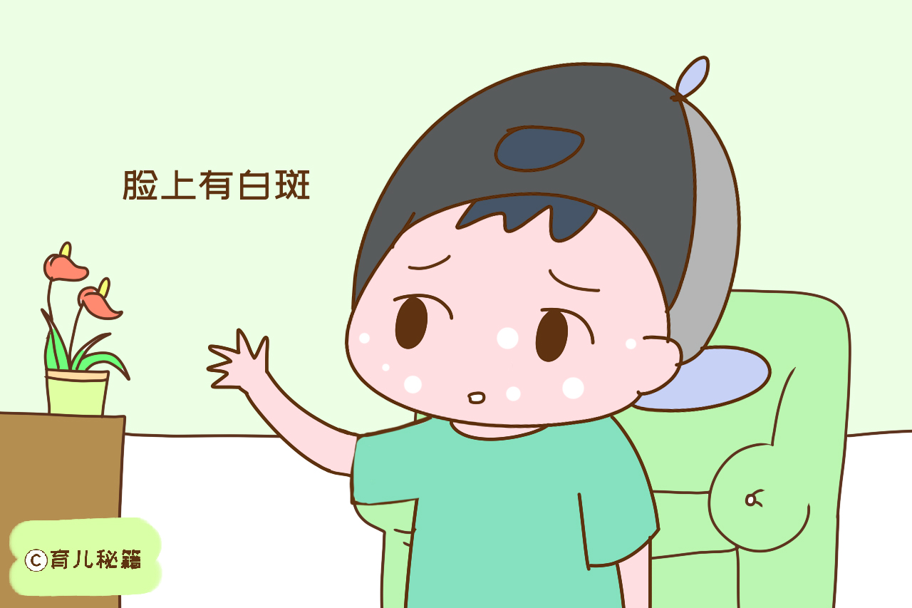 乐乐有段时间脸上就总有白斑,当时乐乐奶奶以为是虫斑,看了西医,医生
