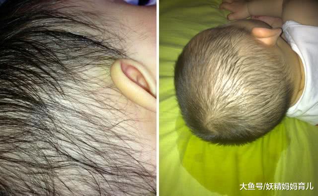 孩子睡觉，头爱出汗，是真的热还是缺钙？儿童盗汗4大原因