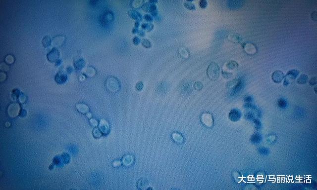 不嚇您!超等实菌去了,1/3传染者30天内灭亡,今朝无药可救……