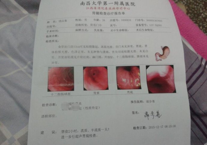 慢性非萎缩性胃炎可以买保险吗