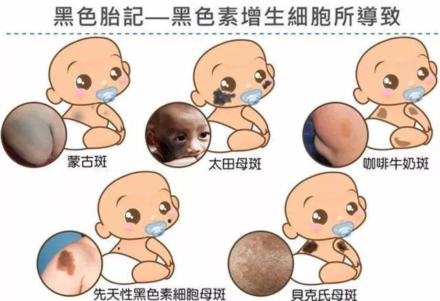 如何区分中国人韩国人和日本人 祖先留下3大印记 仅炎黄子孙有 娱乐资讯 存满娱乐网