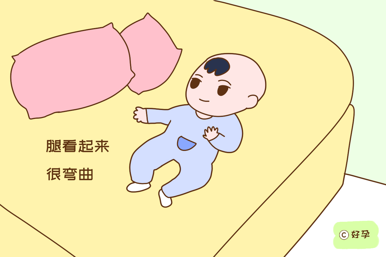 宝宝腿不直就是O型腿？若在这几个时间段，腿有点弯很正常