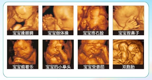 准妈妈看过来！孕期不能错过的4项检查