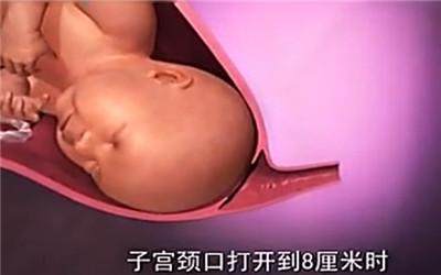 顺产全过程(附图), 母亲太伟大了