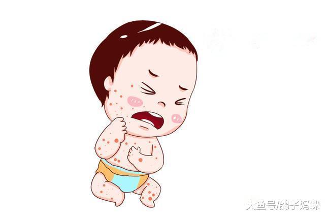宝宝5种常见的皮肤状况, 用错药, 小心越治越糟