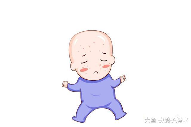 孩子出疹子，别傻傻地以为只是病毒疹