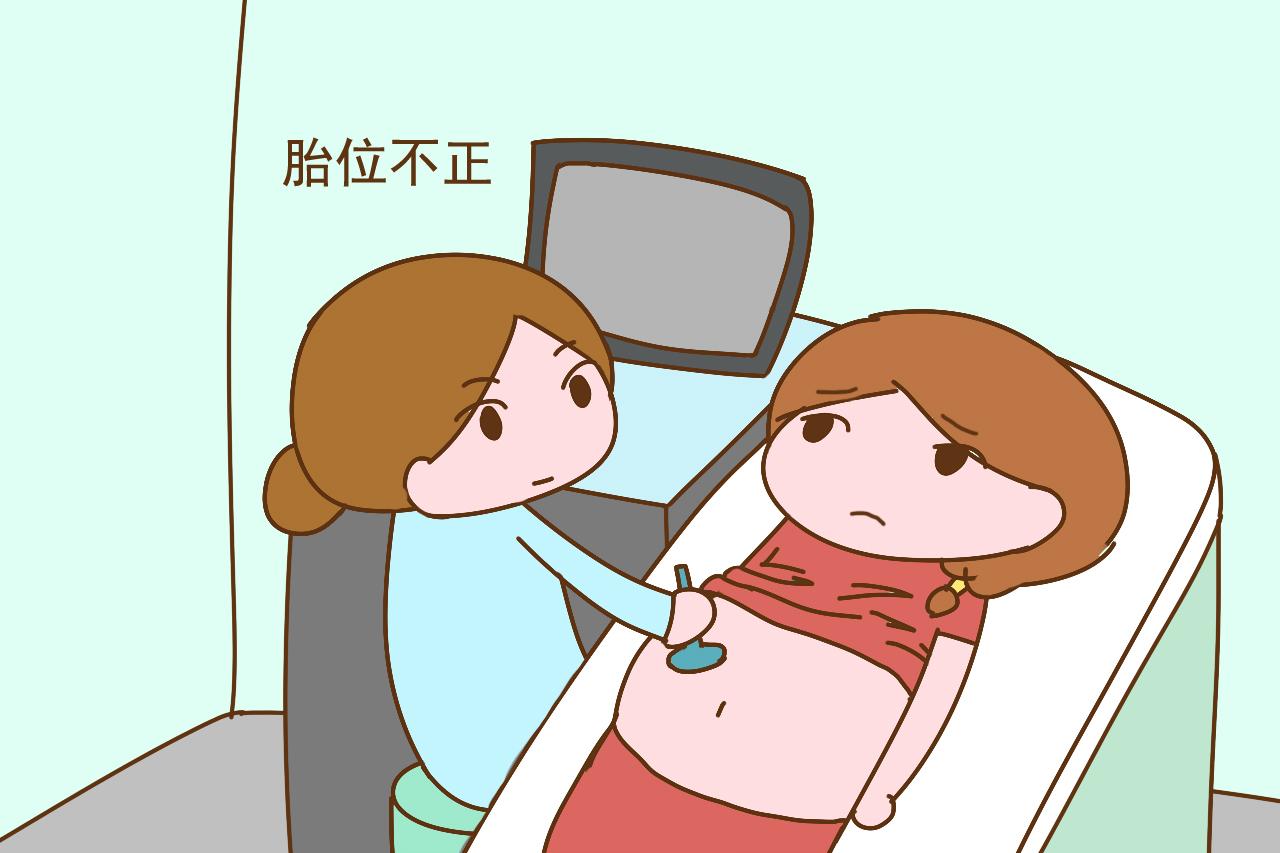 妇产科医生建议：孕妈出现这几种情况，请提前选择剖腹产手术