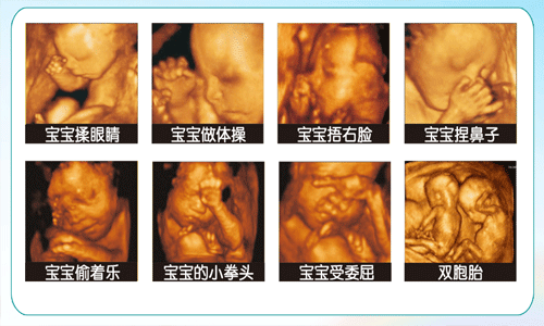 孕期为什么要做四维，四维主要检查什么