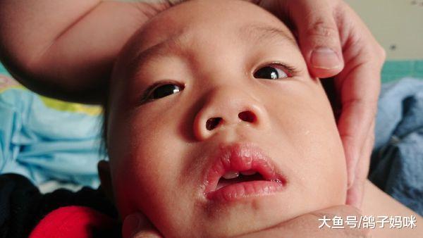 住孩子鼻孔一晚的黄豆，惊魂历险记