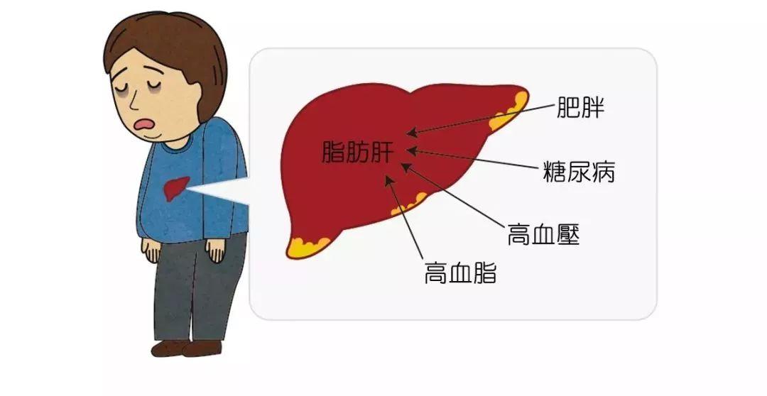 【992 | 健康】肝脏"油"多了,医生给出"四张处方"赶走脂肪肝