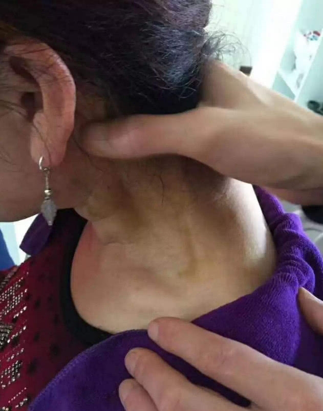 艾滋病传染人数逐年上升?身上3大