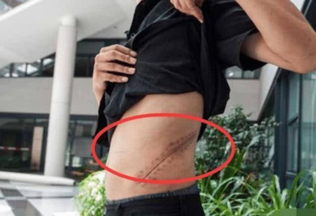 苹果|当年那个宁愿卖肾，花4000块人民币买苹果手机的王刚，现状如何了