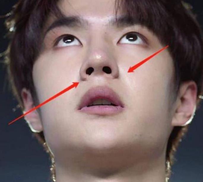 王一博《有翡》被退了?脸僵,近照疤痕明显被吐槽演技堪忧!