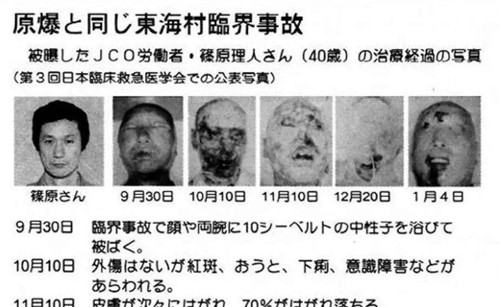 当年因捡了来历不明 钥匙链 失去双腿左臂的宋学文 后来怎样 历史资讯 存满娱乐网