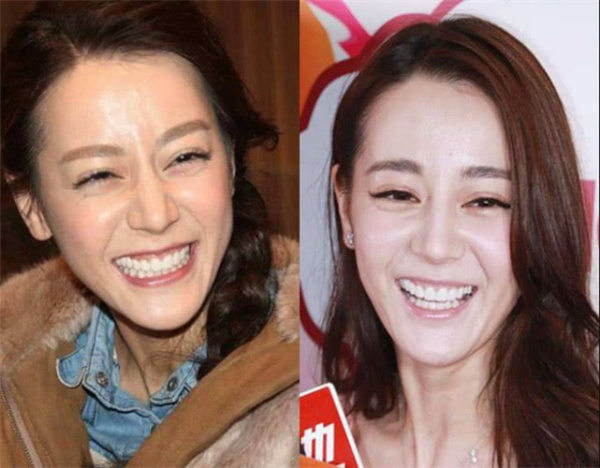女星张嘴大笑时:赵丽颖可爱,迪丽热巴呲牙,看到她王祖蓝都输了!