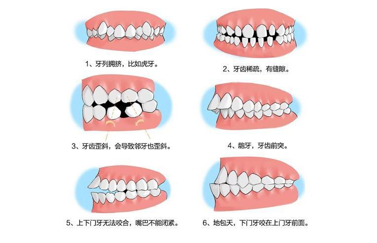 谣言 吃饭咬舌头是因为馋肉 原因竟是这几种 最后一种最严重 要小心 生活资讯 娱乐新闻网