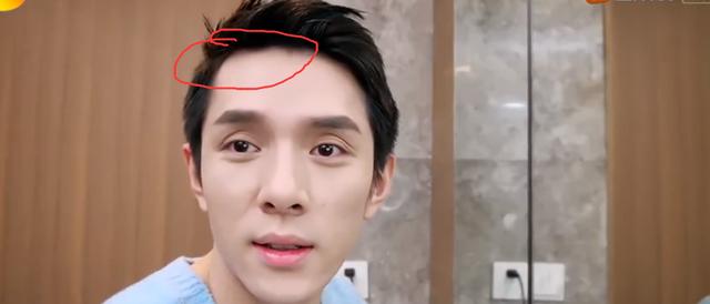 李佳琦化妆前后差距大,素颜暴露多处缺陷,与何炅视频颜值输了