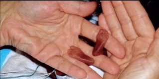 【世界上最小的婴儿，比巴掌还小