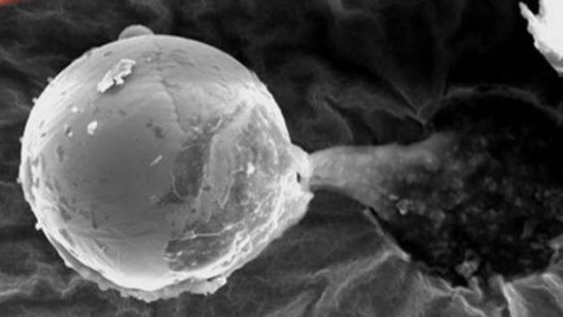 平流层 2013年在平流层发现一金属球，晶体表面有生物喷出，疑似外星生物