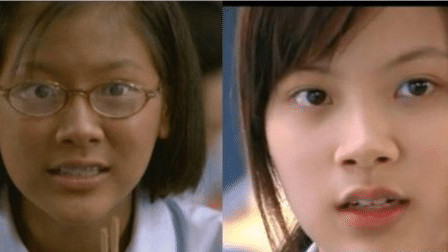 护肤 泰国打“美白针”的女人，整容9年只为“皮肤回春”，如今啥样了