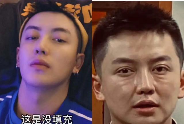 男网红整容变毁容,术后哭诉自己变老20岁,网友:前后对比没法看 男网红整容变毁容,术后哭诉自己变老20岁,网友:前后对比没法看