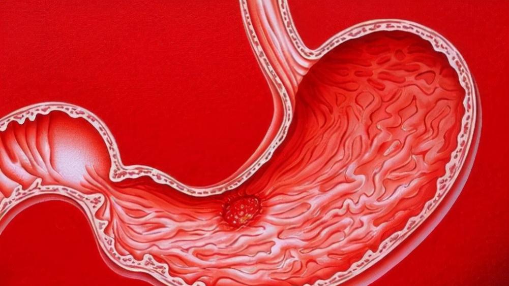 辣椒|三甲医院呼吁：厨房里3种调料，或比辣椒还伤胃，很多人不知道，还天天吃