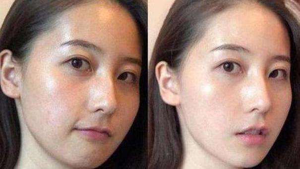 电视剧 “清水洗脸”和“洗面奶洗脸”，哪个对皮肤更好？原来我洗错了