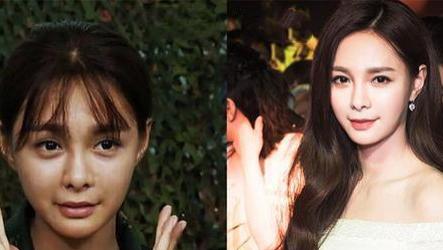 黑色素|泰国女子连续打了6年“美白针”，如今的变化，网友直呼不可思议