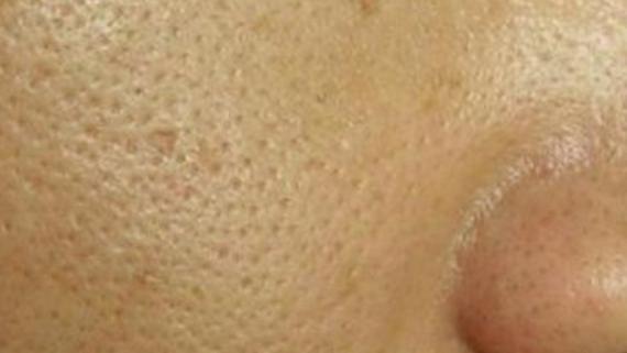 护肤品|护肤品能有效缩小毛孔吗？一次性告诉你，收缩毛孔真正有效的方法！