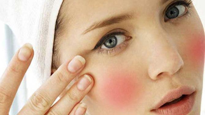 敏感肌该如何正确地护肤？