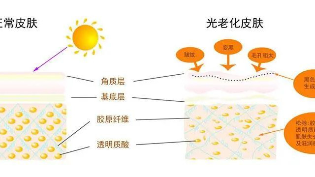 腰果 为什么说，预防95%的皮肤问题，少不了补水