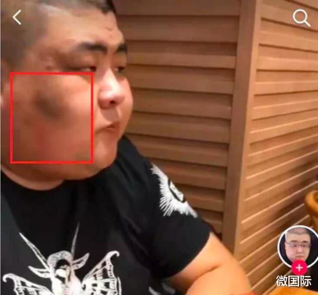 网红泡泡龙去世生前被好友强灌花生油照片曝光网友感到不适