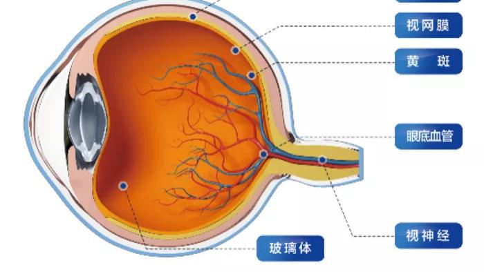 中牟眼健康|眼底不是谜，是这几类疾病的信号灯