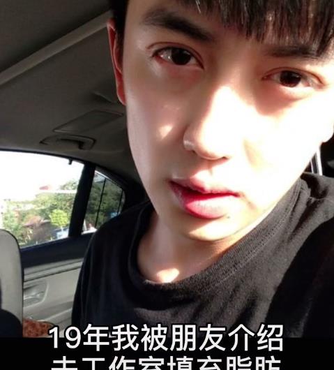 男网红整容变毁容,术后哭诉自己变老20岁,网友:前后对比没法看 男网红整容变毁容,术后哭诉自己变老20岁,网友:前后对比没法看