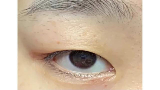 瓜子 单眼皮肿眼泡，眼妆不容易晕的秘诀都给我学。