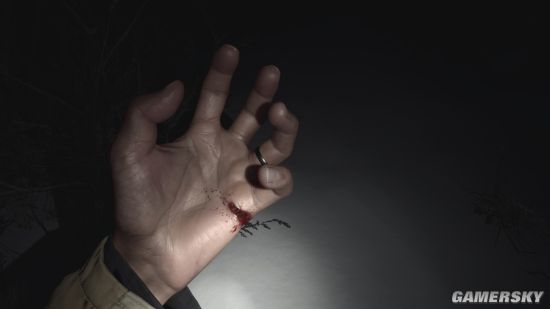 《【煜星娱乐平台怎么注册】IGN统计《生化危机8》主角伊森手受伤场面 洗手战神名不虚传》
