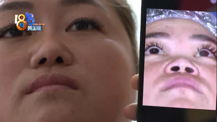 底妆 做了两次手术，现在两个问题