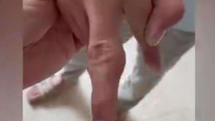 西葫芦|每天一杯！14岁男孩手指关节大如锤，这些颇受孩子欢迎的美食要少吃