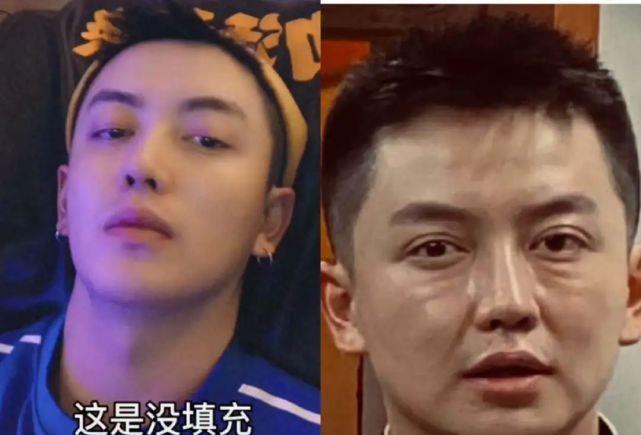 男网红整容变毁容,术后哭诉自己变老20岁,网友:前后对比没法看 男网红整容变毁容,术后哭诉自己变老20岁,网友:前后对比没法看