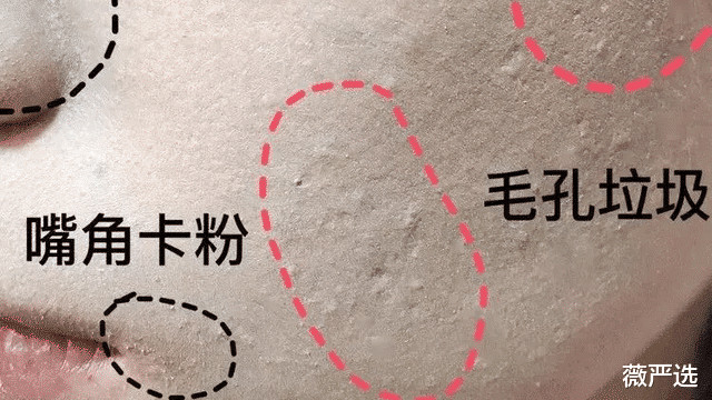 薇娅 有种尴尬叫“卡粉”！女明星妆容“翻车”，这粉底是上了多少层？