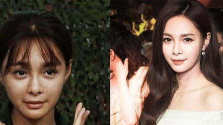 短裙 泰国女子连续打了6年“美白针”，如今的变化，网友直呼不可思议