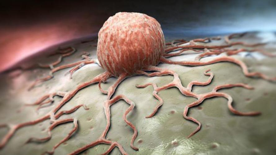 吕周小盼说情感|癌症只能“等死”？肿瘤专家：做好“3件事”，或能多活20年