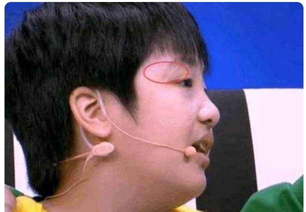 儿子录制节目意外受伤,他怒斥芒果台,如今儿子长成这样! 儿子录制节目意外受伤,他怒斥芒果台,如今儿子长成这样!