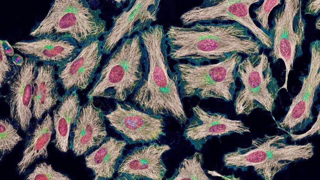 癌细胞 还对癌细胞望而生畏？科学家把这种癌细胞培养5000万吨，只为救人
