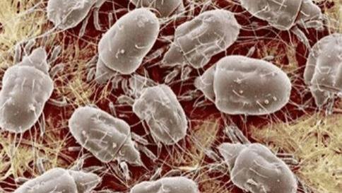 家里螨虫超级多？只需一根草，不到1毛钱，螨虫全部死光光