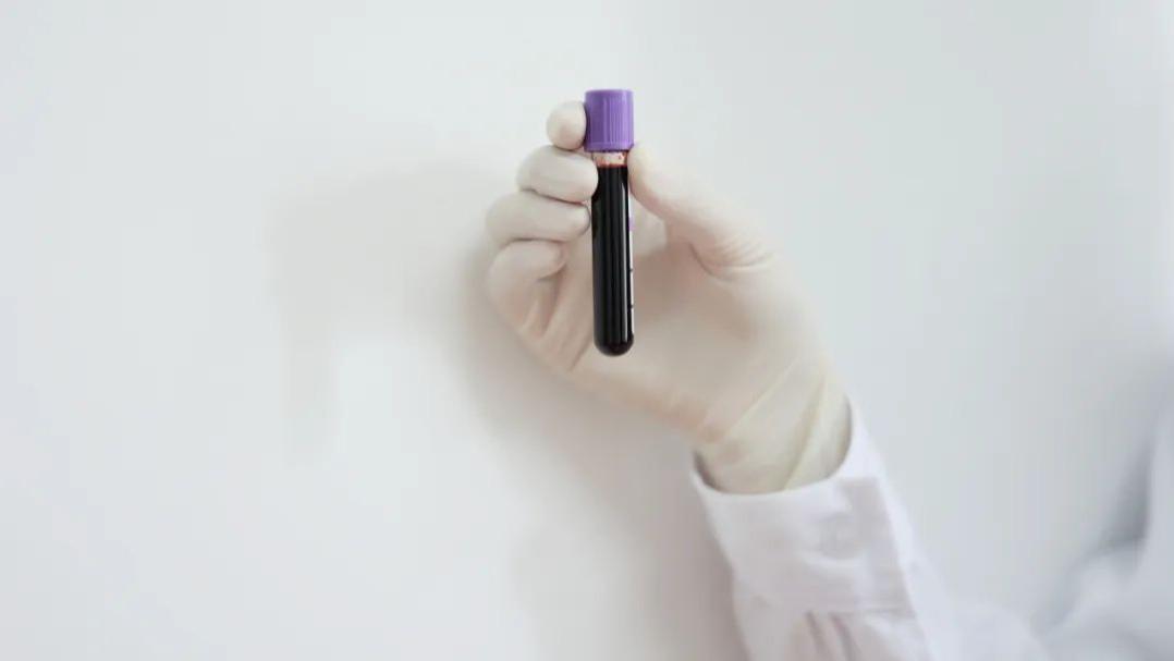 健脾|高血脂患者，做什么运动好？选择这3种运动，帮助降低血脂水平