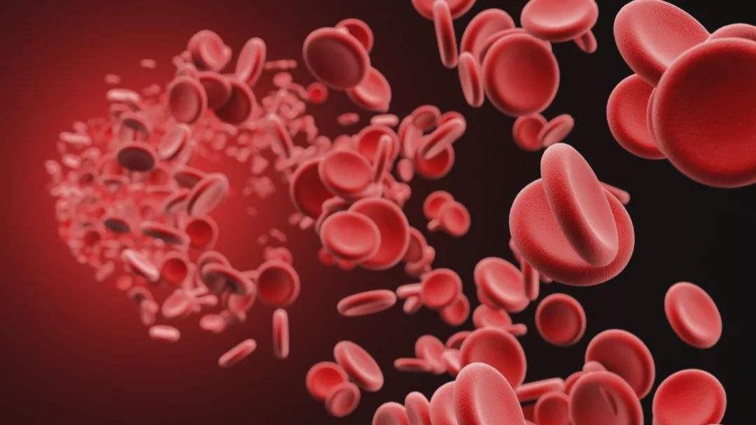 大脑|高血脂，高血压，血管瘀堵，一个方子化瘀通血管，横扫血管垃圾