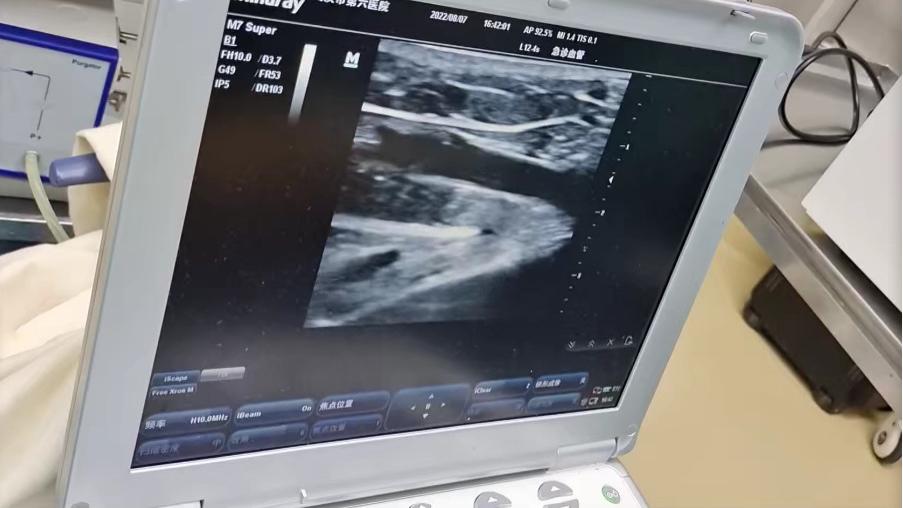 |反复溃烂，久治不愈，很多老烂腿患者一直在做无用功？老烂腿反复怎么办